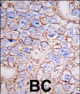 MAPK15 Antibody in Immunohistochemistry (Paraffin) (IHC (P))