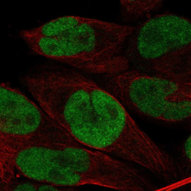 BRD3 Antibody in Immunocytochemistry (ICC/IF)