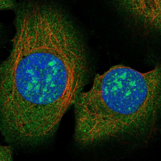 RAD51AP2 Antibody in Immunocytochemistry (ICC/IF)