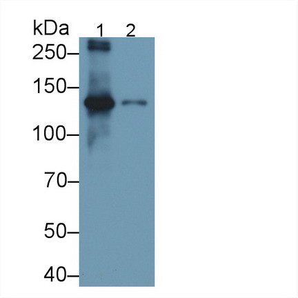 Procollagen I C-Peptide Antibody in Western Blot (WB)