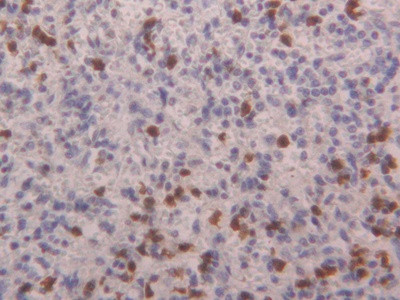 S100A4 Antibody in Immunohistochemistry (Paraffin) (IHC (P))