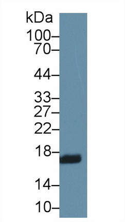 RBP2 Antibody in Western Blot (WB)