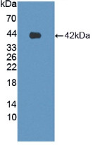 LPHN3 Polyclonal Antibody (PA5-145295)