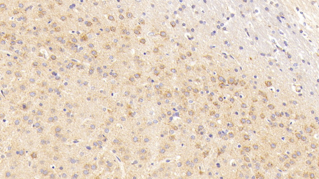 MTCO2 Antibody in Immunohistochemistry (Paraffin) (IHC (P))