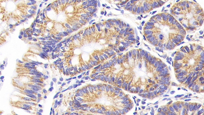 MTCO2 Antibody in Immunohistochemistry (Paraffin) (IHC (P))