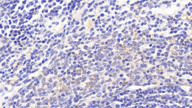 MTCO2 Antibody in Immunohistochemistry (Paraffin) (IHC (P))