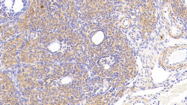 MTCO2 Antibody in Immunohistochemistry (Paraffin) (IHC (P))