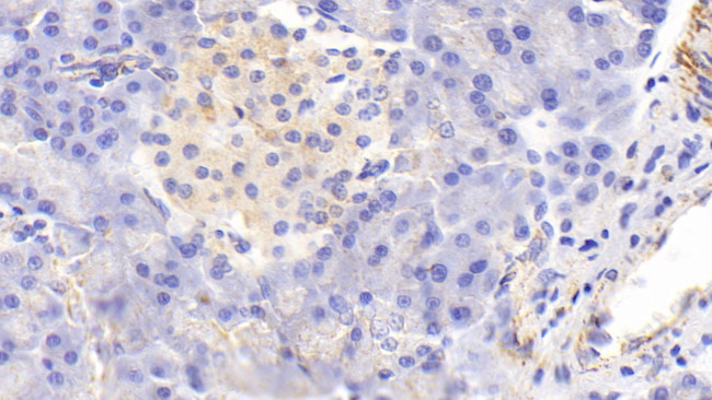 MTCO2 Antibody in Immunohistochemistry (Paraffin) (IHC (P))