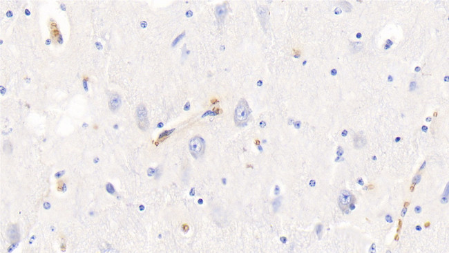 Hemoglobin Antibody in Immunohistochemistry (Paraffin) (IHC (P))