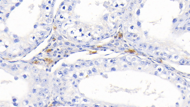 Hemoglobin Antibody in Immunohistochemistry (Paraffin) (IHC (P))