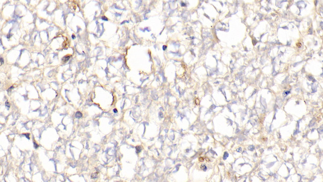 Hemoglobin Antibody in Immunohistochemistry (Paraffin) (IHC (P))