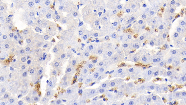 Hemoglobin Antibody in Immunohistochemistry (Paraffin) (IHC (P))