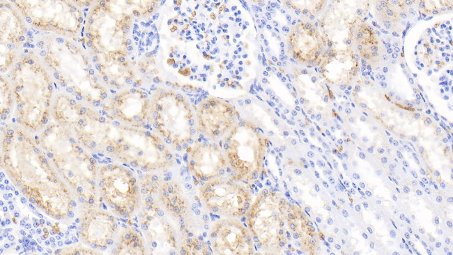 Hemoglobin Antibody in Immunohistochemistry (Paraffin) (IHC (P))