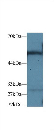 G6PD Antibody in Western Blot (WB)