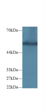 G6PD Antibody in Western Blot (WB)