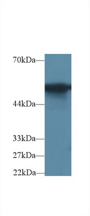 G6PD Antibody in Western Blot (WB)