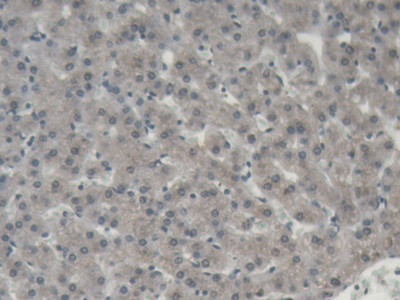 ORM1 Antibody in Immunohistochemistry (Paraffin) (IHC (P))