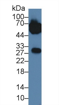 ORM1 Antibody in Western Blot (WB)