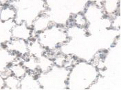 CES1 Antibody in Immunohistochemistry (Paraffin) (IHC (P))