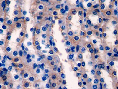 LAD1 Antibody in Immunohistochemistry (Paraffin) (IHC (P))