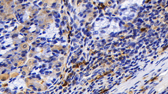 Tryptase Antibody in Immunohistochemistry (Paraffin) (IHC (P))