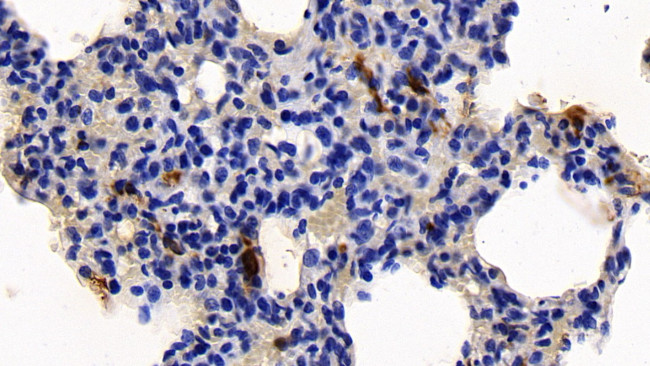 Tryptase Antibody in Immunohistochemistry (Paraffin) (IHC (P))