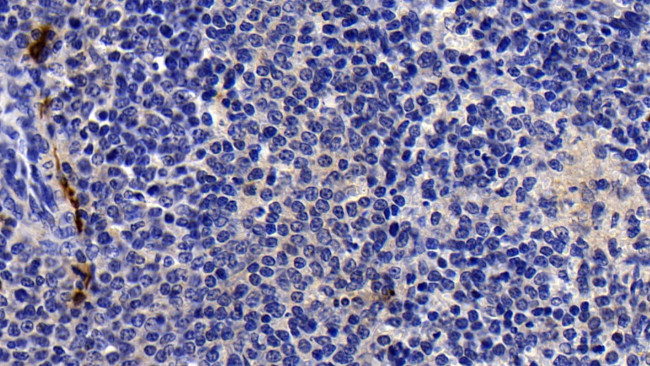 Tryptase Antibody in Immunohistochemistry (Paraffin) (IHC (P))