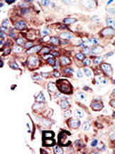 Axl Antibody in Immunohistochemistry (Paraffin) (IHC (P))