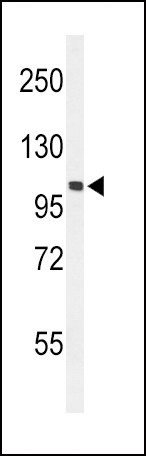 EphA2 Antibody in Western Blot (WB)