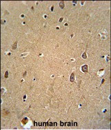 EphA6 Antibody in Immunohistochemistry (Paraffin) (IHC (P))