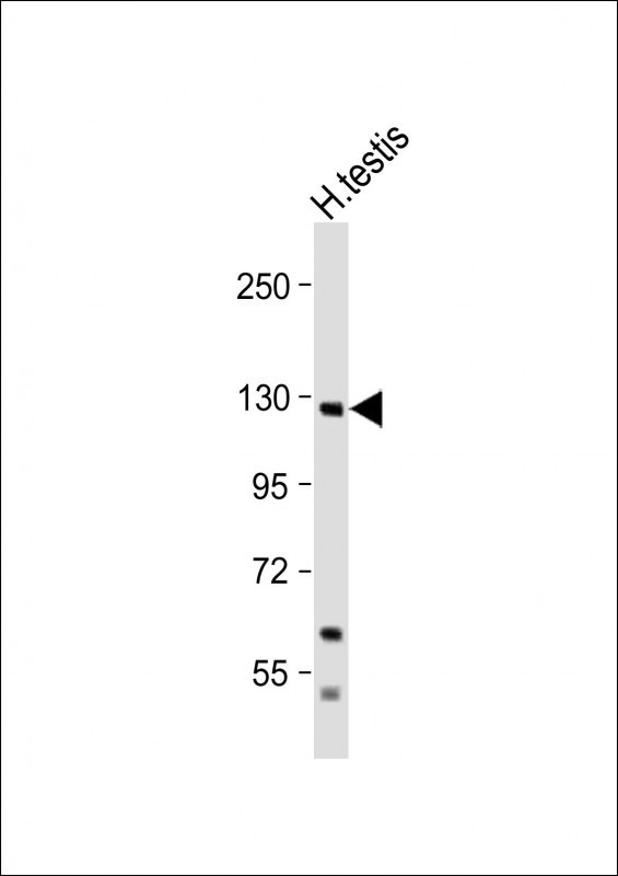 EphA6 Antibody in Western Blot (WB)