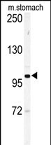 EphA6 Antibody in Western Blot (WB)