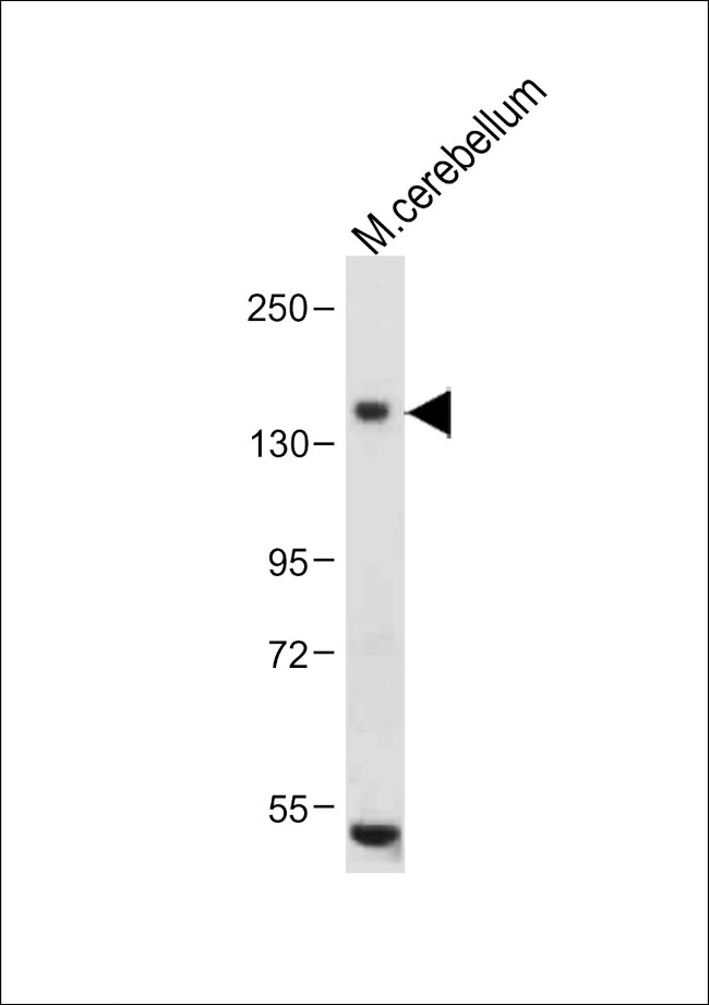 c-Kit Antibody in Western Blot (WB)