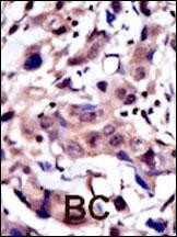 MUSK Antibody in Immunohistochemistry (Paraffin) (IHC (P))