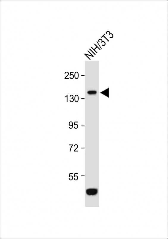 ROR1 Antibody in Western Blot (WB)