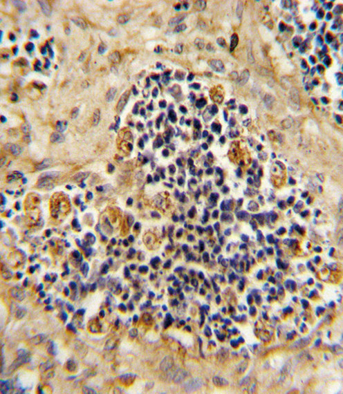 ROR2 Antibody in Immunohistochemistry (Paraffin) (IHC (P))