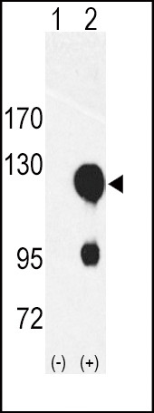 ROR2 Antibody in Western Blot (WB)