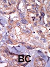 TXK Antibody in Immunohistochemistry (Paraffin) (IHC (P))