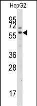 GRK7 Antibody in Western Blot (WB)