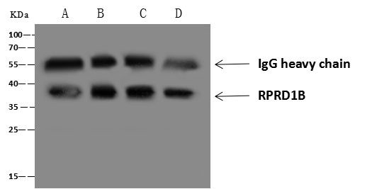 RPRD1B Antibody in Immunoprecipitation (IP)