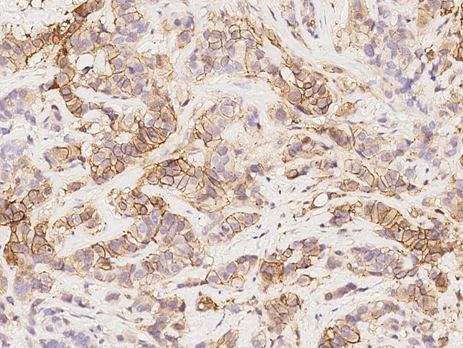 NDRG1 Antibody in Immunohistochemistry (Paraffin) (IHC (P))