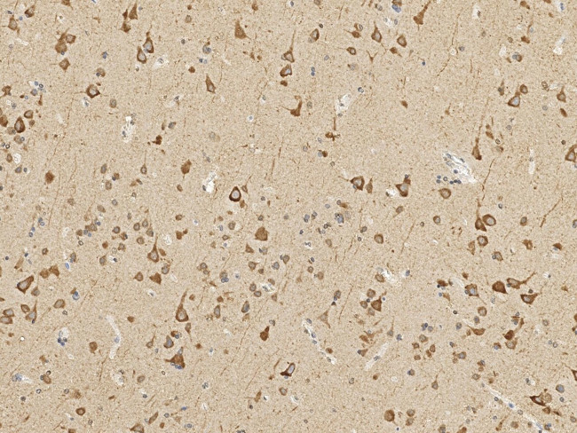 HABP4 Antibody in Immunohistochemistry (Paraffin) (IHC (P))