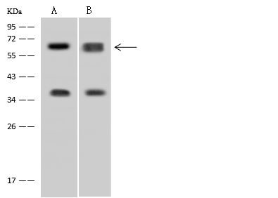 DDX56 Antibody in Western Blot (WB)