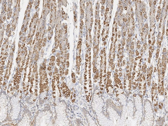 MTCO2 Antibody in Immunohistochemistry (Paraffin) (IHC (P))