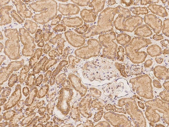 ROBO3 Antibody in Immunohistochemistry (Paraffin) (IHC (P))