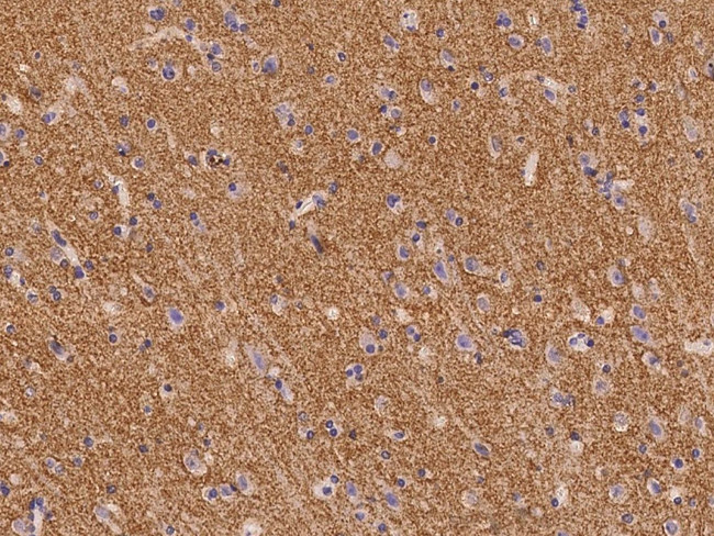 SV2B Antibody in Immunohistochemistry (Paraffin) (IHC (P))