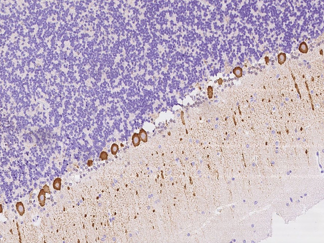 NBPF15 Antibody in Immunohistochemistry (Paraffin) (IHC (P))