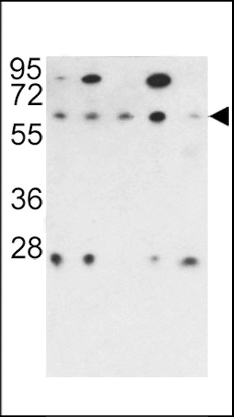 PPP2R3B Antibody in Western Blot (WB)