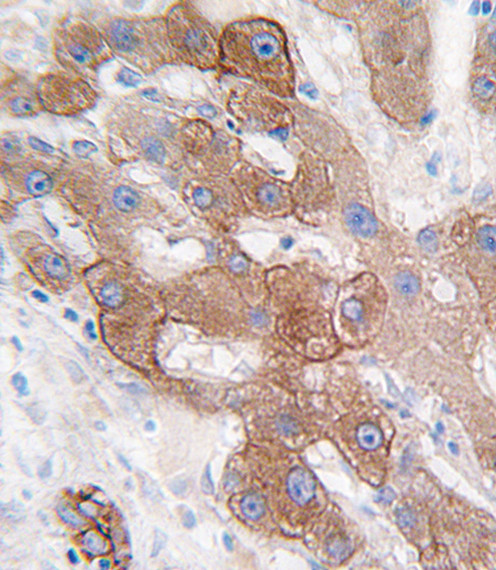 CYP3A5 Antibody in Immunohistochemistry (Paraffin) (IHC (P))