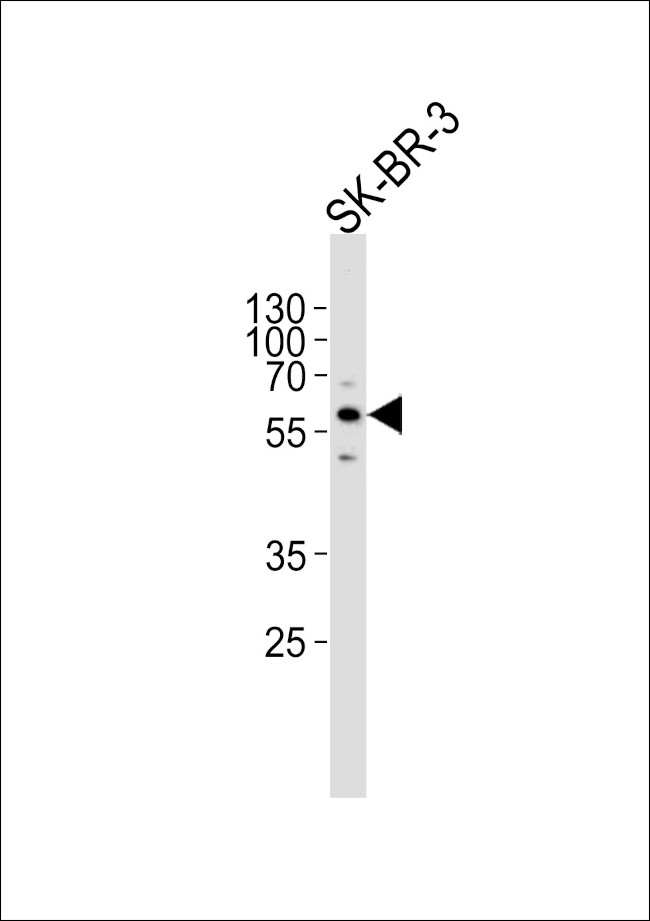 CYP3A5 Antibody in Western Blot (WB)